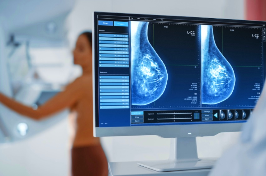 Mulheres em consulta médica sobre câncer de mama