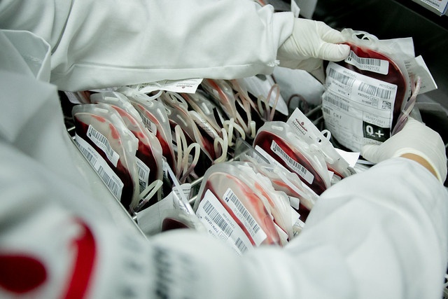 Atualização de procedimentos hemoterápicos pelo Ministério da Saúde do Brasil